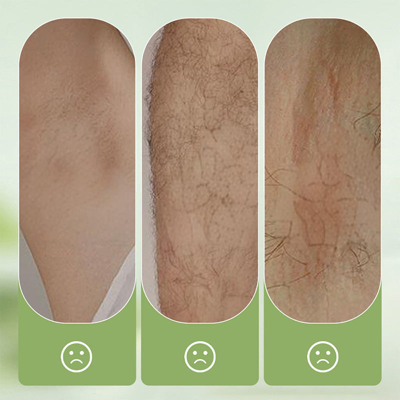 💫 PROMO LIMITÉE 50% DE RÉDUCTION ! ✨ Crème Dépilatoire – Douce, Sans Irritation, 230g, Pour Hommes/Femmes 🧴