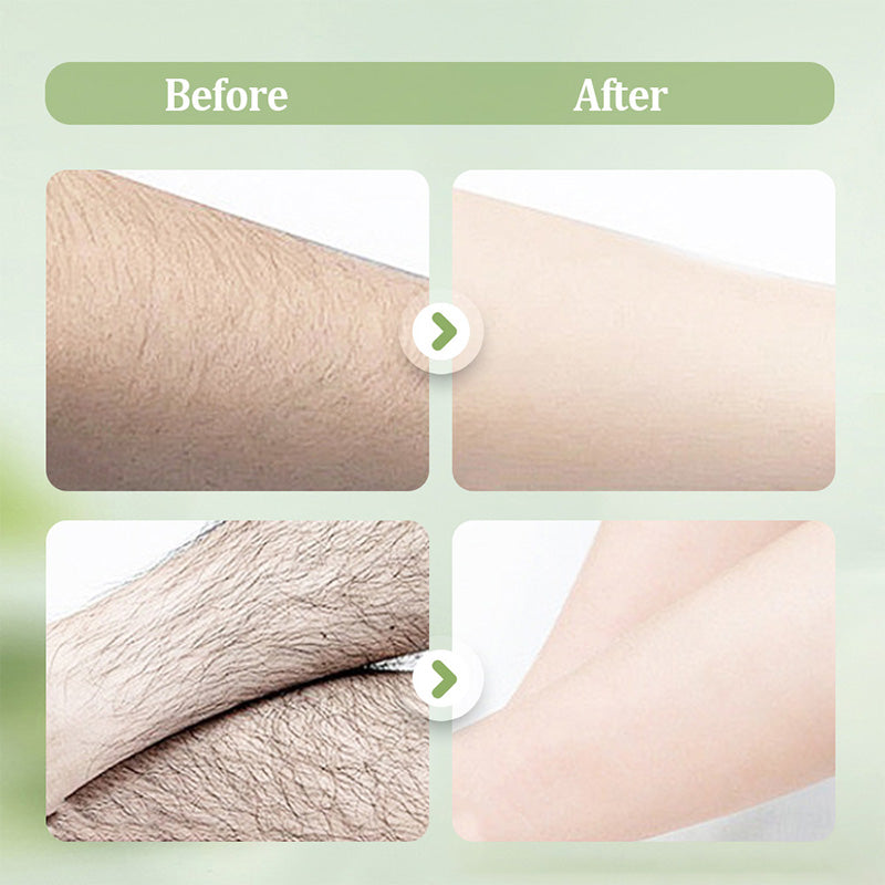 💫 PROMO LIMITÉE 50% DE RÉDUCTION ! ✨ Crème Dépilatoire – Douce, Sans Irritation, 230g, Pour Hommes/Femmes 🧴